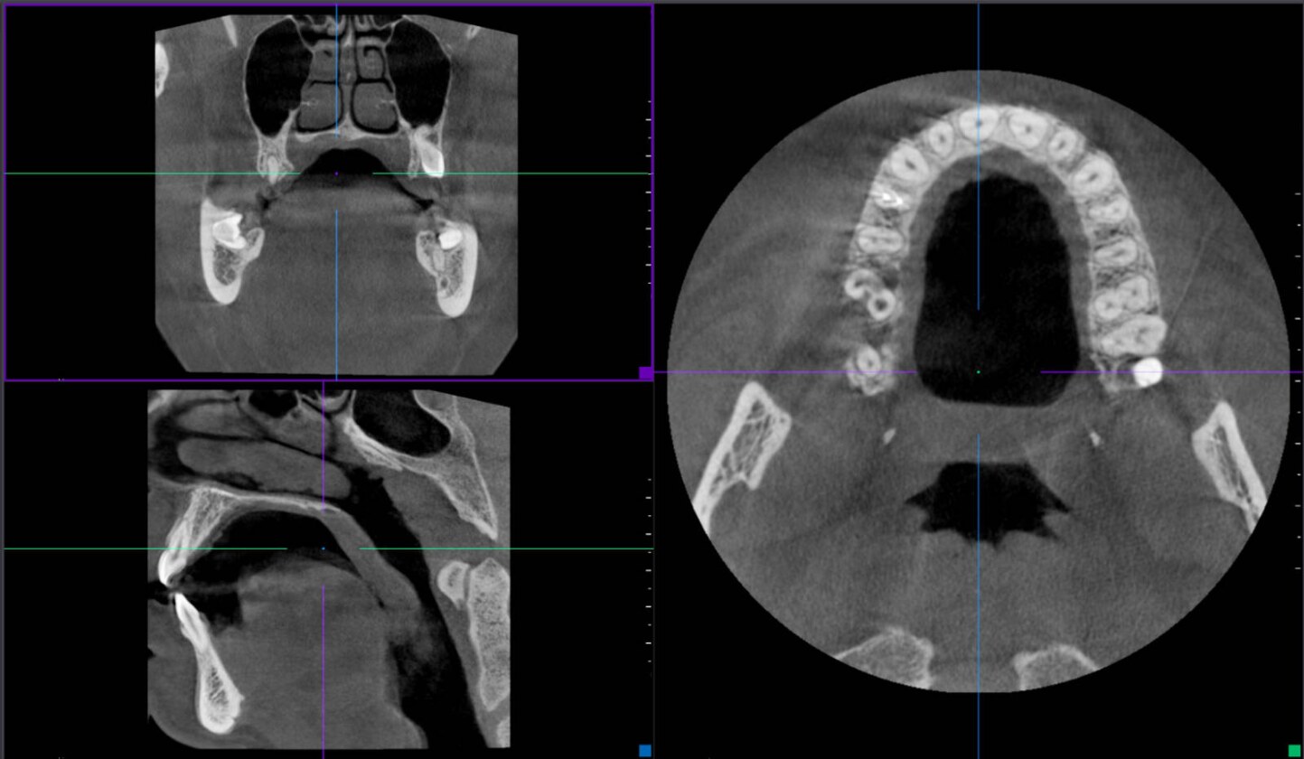 Radiologie dentaire