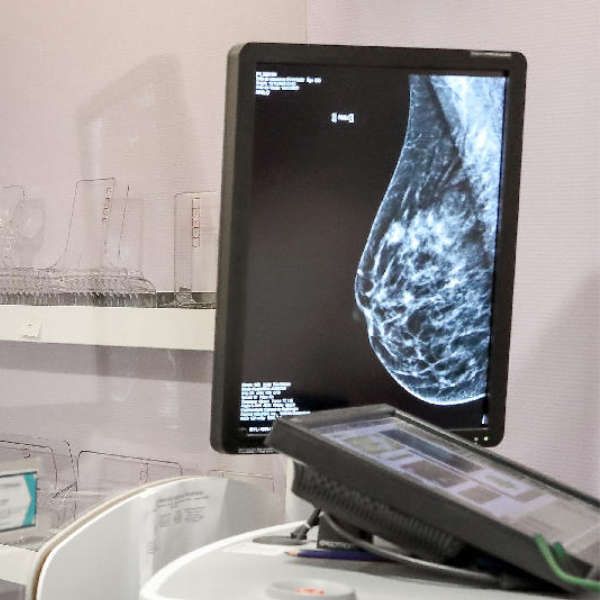 mammographie périgueux